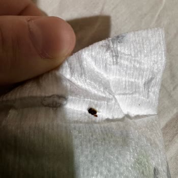 Bebek Bezinde Böcek Şoku