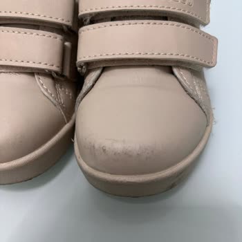 Vicco Ayakkabısında Yaşanan Kalite Sorunu Ve Müşteri Hizmetleri Hayal Kırıklığı