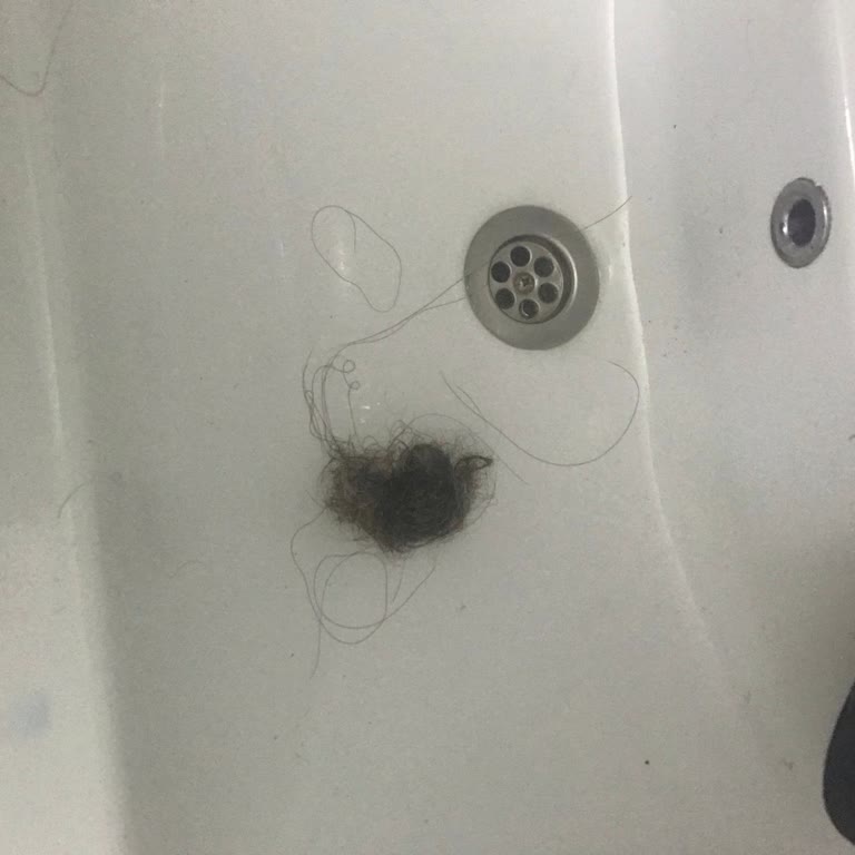 Bioblas Şampuan Saç Dökülmesini Artırdı