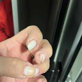 Tırnak Bakımında Kalitesiz Hizmet Ve Ekstra Ücret Sorunu