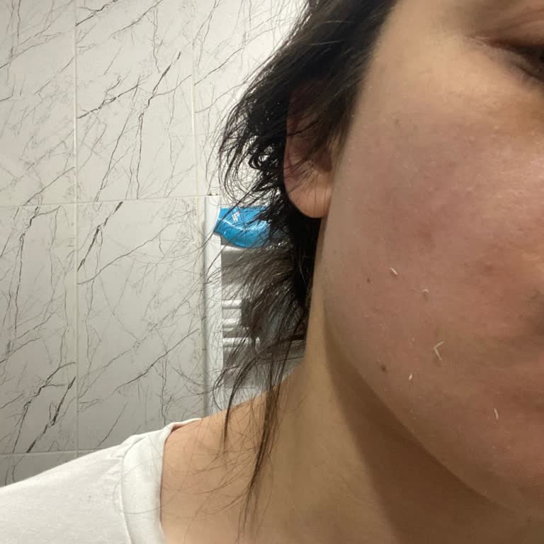 Bioderma Güneş Kremi Beklentileri Karşılamıyor