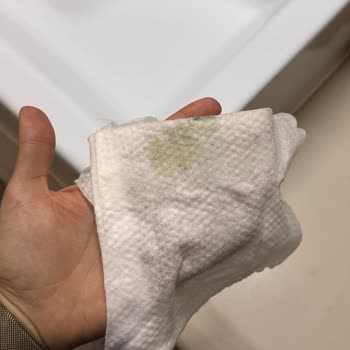 Islak Mendilden Çıkan Anormal Madde Şok Etti