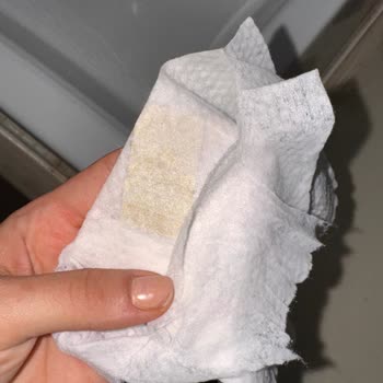 Islak Mendilden Çıkan Anormal Madde Şok Etti