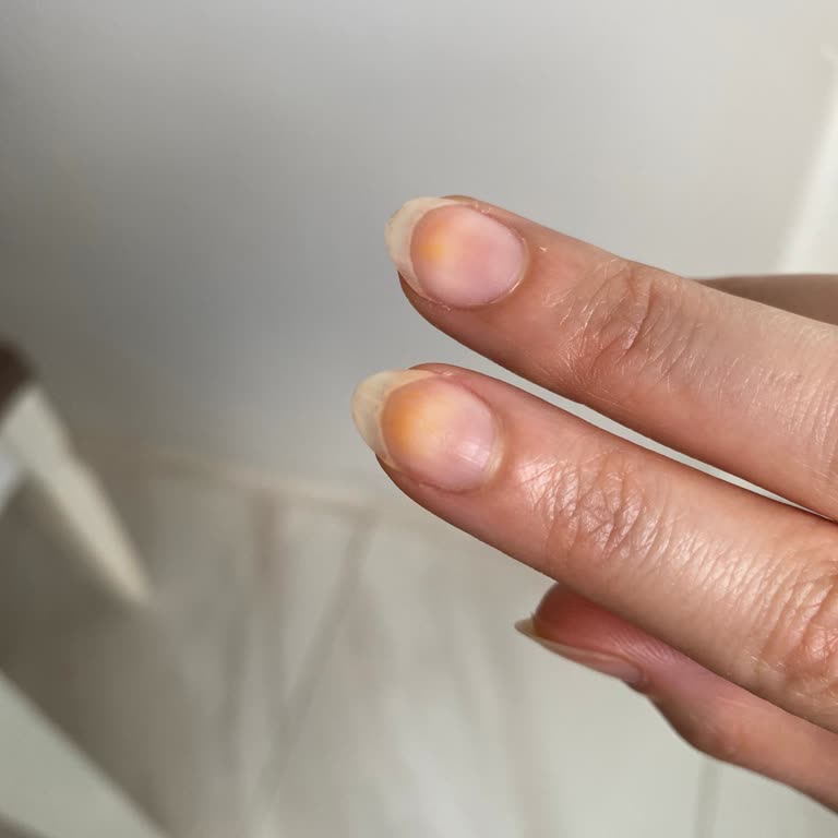 Flormar Ojesi Tırnaklarda Kalıcı Leke Bıraktı