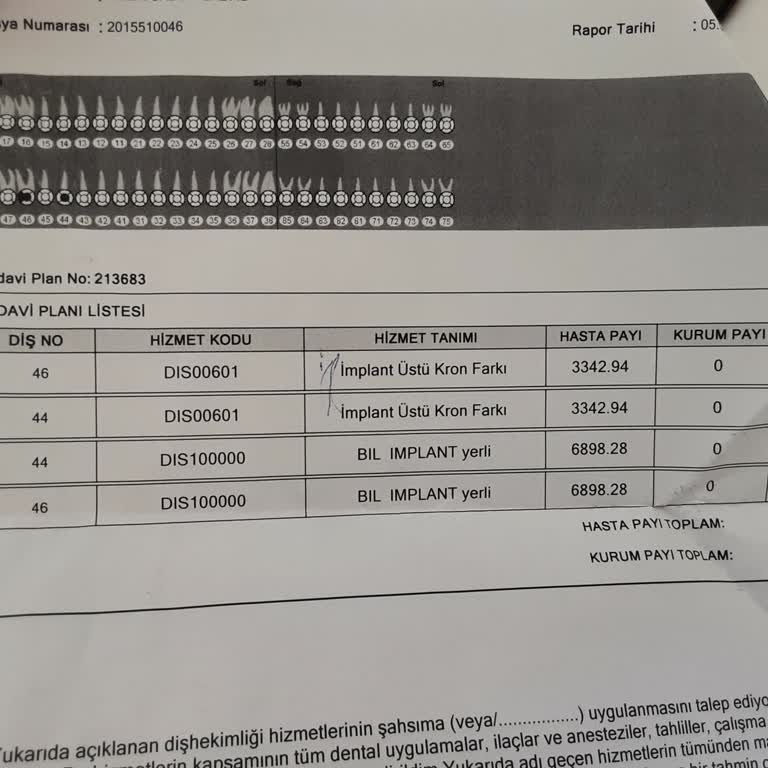 Yanlış Bilgilendirme Sonucu Diş Kaybı