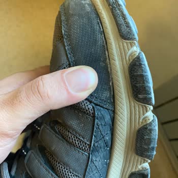 Skechers Ayakkabıda Kalite Ve Hizmet Hayal Kırıklığı