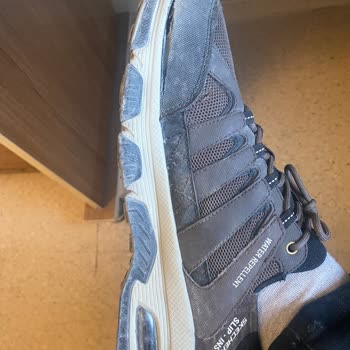 Skechers Ayakkabıda Kalite Ve Hizmet Hayal Kırıklığı