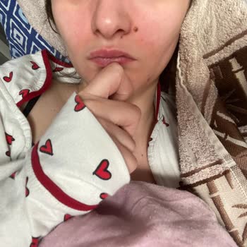 Sebo Active Clear Tonik Ciltte Kızarıklık Ve Yanma Yaptı