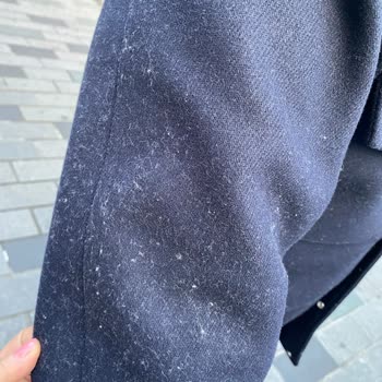 Zara Kabanı Toz Topluyor Astımı Tetikliyor