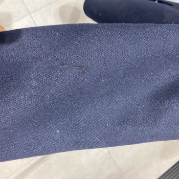 Zara Kabanı Toz Topluyor Astımı Tetikliyor