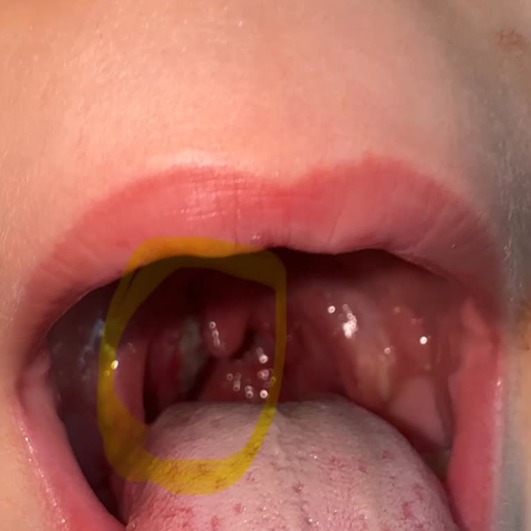 Doktor İnatçılığı Yüzünden Çocuğum Tehlikede!