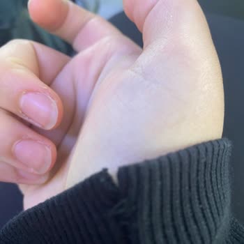 Yanlış Fiyat Ve Defolu Ürün Sorunu