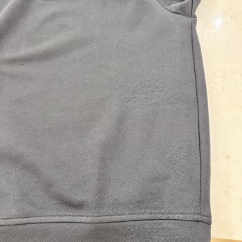 Lacoste Ürünü Kalite Sorunu Ve Müşteri Hizmetleri Hayal Kırıklığı
