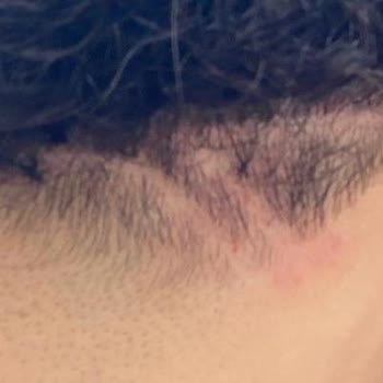 Yanlış Kesim Ve Memnuniyetsizlik