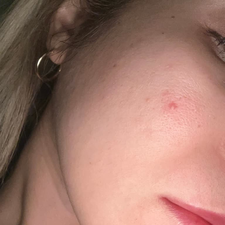 Estee Lauder Ürünleri Cildimde Aşırı Sivilce Yaptı