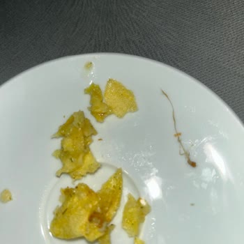 BİM'den Aldığım Ürünlerde Yabancı Cisim Şoku!