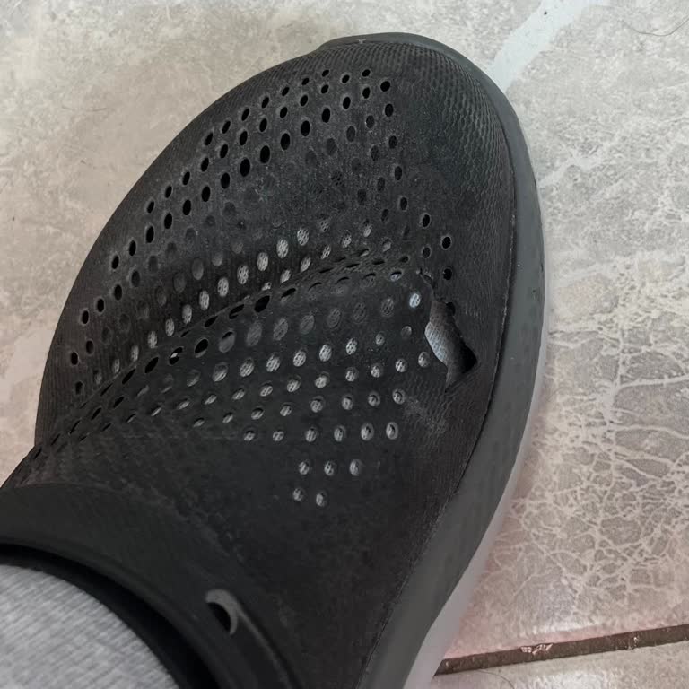 Ameliyathane Kullanımında Yıpranan Crocs Terlik İçin Hayal Kırıklığı