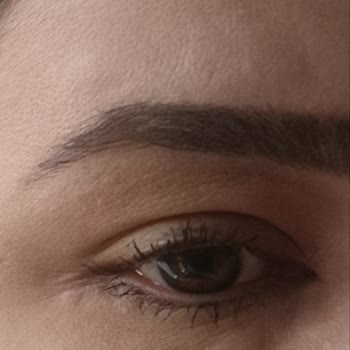 Elidor Keratin Bakım Saç Maskesi Alerjik Reaksiyon Yarattı