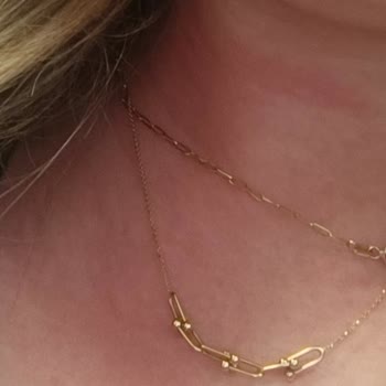 Elidor Keratin Bakım Saç Maskesi Alerjik Reaksiyon Yarattı