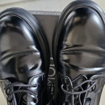 Rugan Ayakkabılar Ayaklarımı Yara Yaptı Ve Değişim Reddedildi