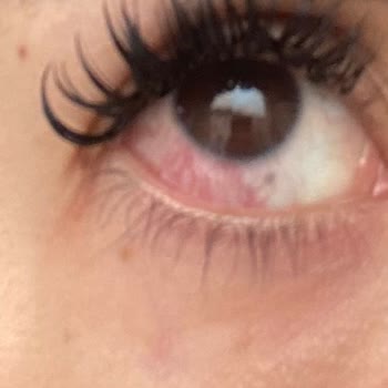 Lavinya Nail Beauty İpek Kirpik Uygulaması Sonrası Sağlık Sorunları ve Kötü Hizmet Deneyimi