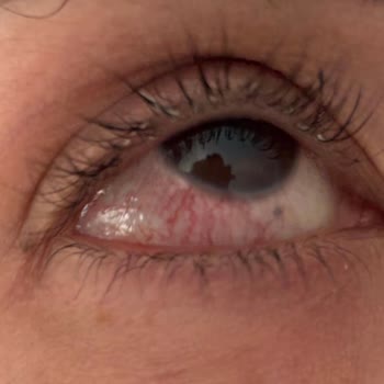 Lavinya Nail Beauty İpek Kirpik Uygulaması Sonrası Sağlık Sorunları ve Kötü Hizmet Deneyimi