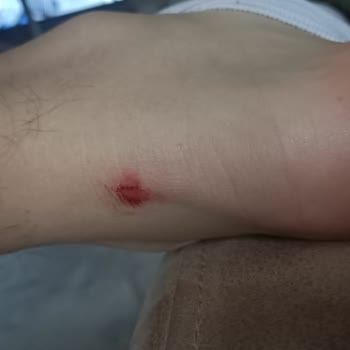 Puma Ayakkabılar Bilek Yaralıyor: Mağaza İade Talebini Reddediyor