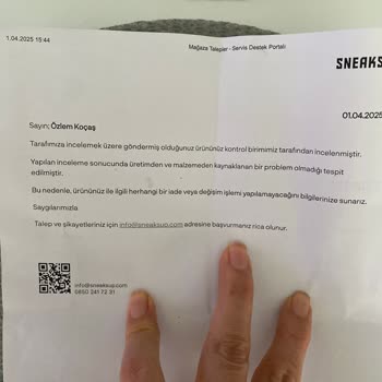 4 Ayda Soyulan Ayakkabı Derisi