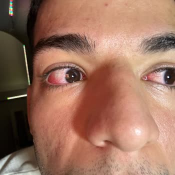 Tuğba Yeşilova Güzellik Az Kalsın Gözlerimden Oluyordum