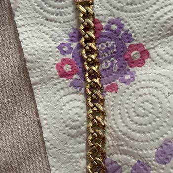 Garantili Bilekliğim İlk Hafta Sorun Çıkardı