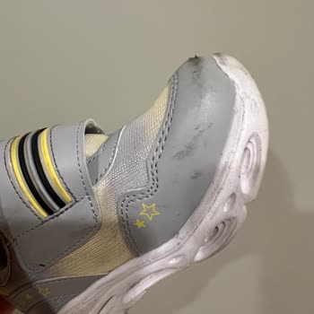 Vicco Ayakkabının Kısa Sürede Deformasyonu Ve İade Sorunu