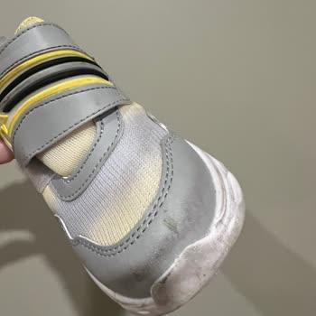 Vicco Ayakkabının Kısa Sürede Deformasyonu Ve İade Sorunu