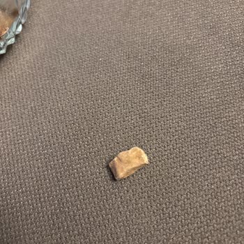 Migros Antep Fıstığı Paketinden Taş Çıktı