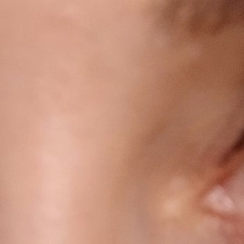 Acuvue Oasys Lenslerde Rahatsızlık Ve Kanlanma Sorunu