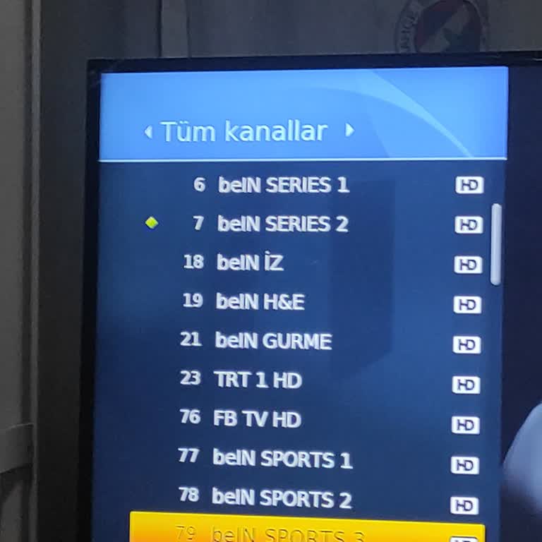 Teknik Servis Ücreti Ve Kanal Sorunlarıyla Mücadele
