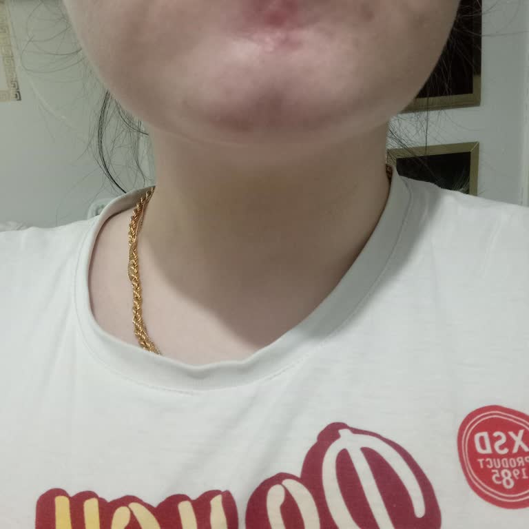 C Vitamini Kullanımı Sonrası Cilt Sorunları