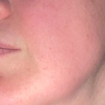 Doğal Ürün Alerjisi: Yves Rocher Lift Pro Collagen!