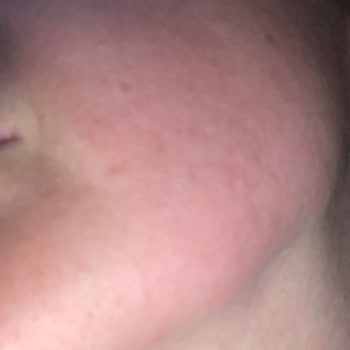 Doğal Ürün Alerjisi: Yves Rocher Lift Pro Collagen!