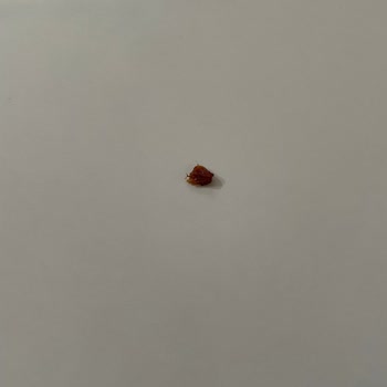 Gold Harvest Kuruyemiş Kuru Erik Aldım İçinden Kabuklar Çıktı