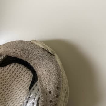 Adidas Çocuk Ayakkabısında Üretim Hatası Ve İade Sorunu!