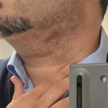 Gıdı Lipo İşleminde Kalıcı Hasar Ve İletişim Sorunu