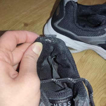 Skechers Ayakkabıda Kalite Sorunu Ve Yetersiz Müşteri Hizmeti