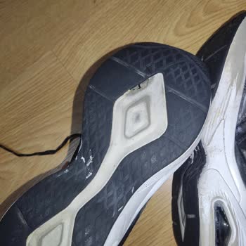 Skechers Ayakkabıda Kalite Sorunu Ve Yetersiz Müşteri Hizmeti