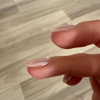 Randevu İhlali Ve Kalitesiz Hizmet