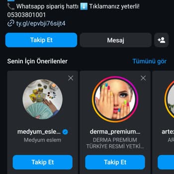 Sahte Lens Ve Kötü Müşteri Hizmeti