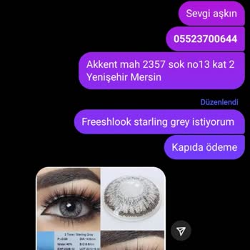 Sahte Lens Ve Kötü Müşteri Hizmeti