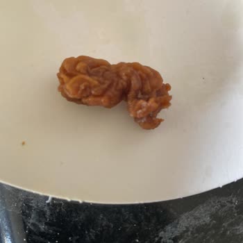 Popeyes Siparişimde Şok Edici Yabancı Madde!