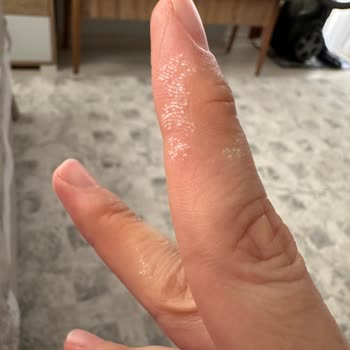 Kimyasal Yanık Tehlikesi: Uyarı Eksikliği