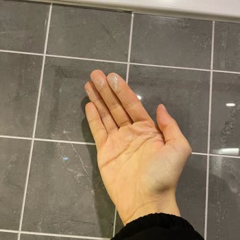 Parke Kabarması Ve Temizlik Fiyaskosu