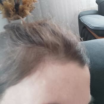 Yeliz Dalkara Güzellik Merkezi Ekstra Ücret Talebi